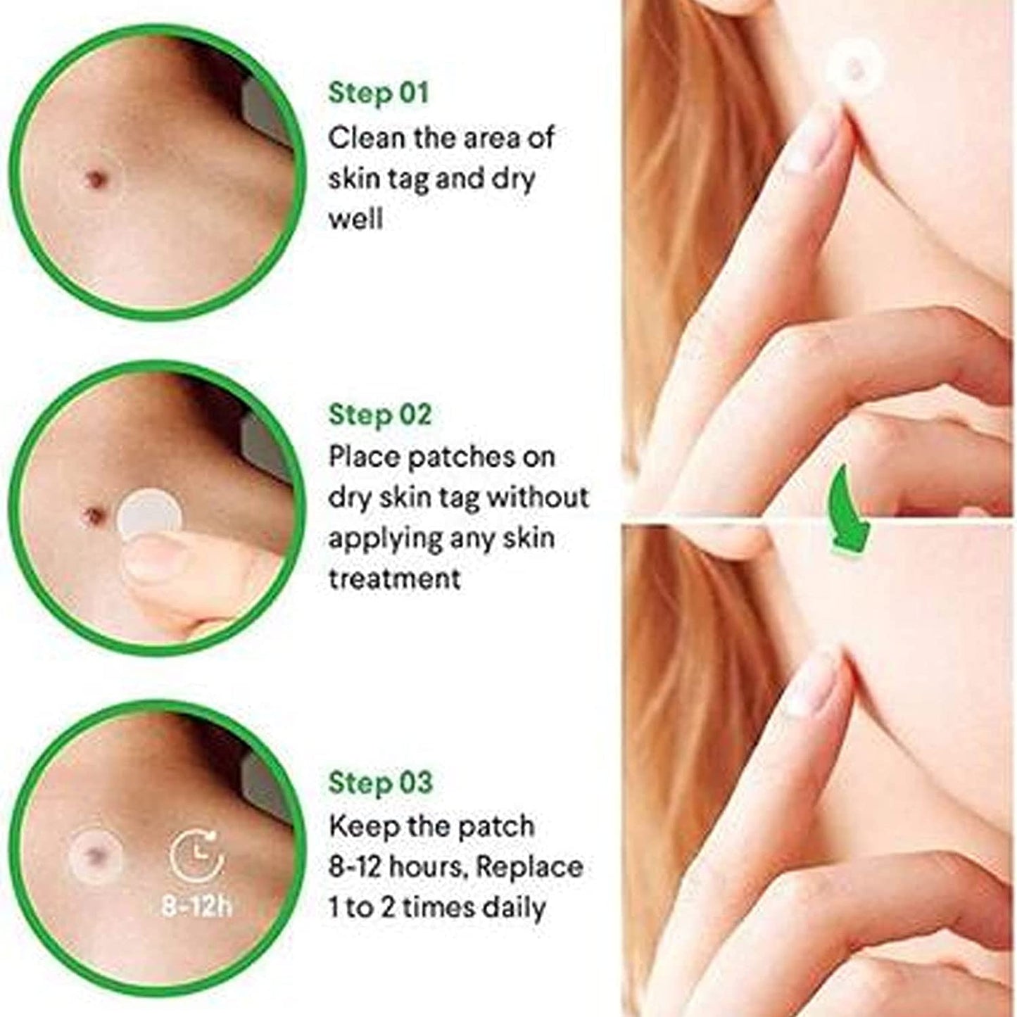 SKIN TAG ACNE PATCH DOTS (108 DOTS )