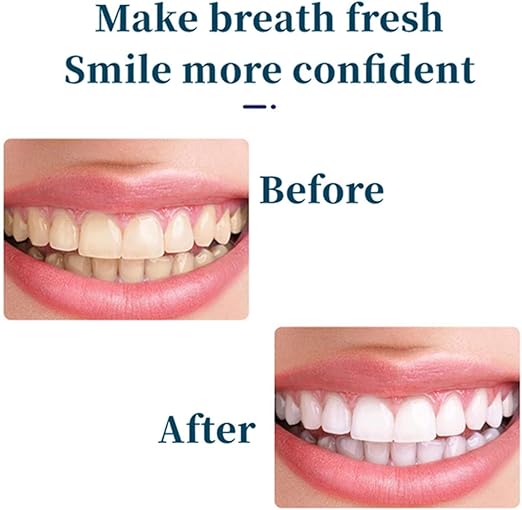 Sp 4 Toothpaste